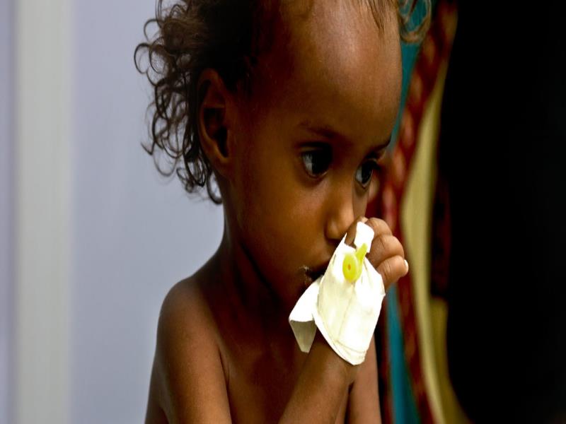©UNICEF/Almahbashi Millones de niños en Yemen están amenazados por la malnutrición y la falta de servicios básicos. Una situación causada por la guerra